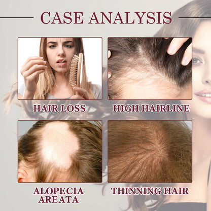 Onion Hair Growth Oil Spray