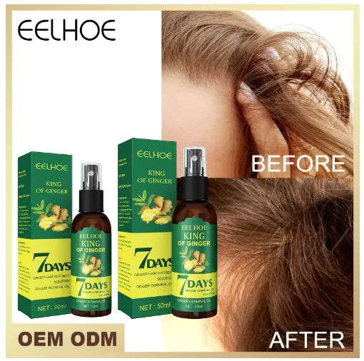 Ginger Essential Oil Spray Conditioner for Hair Regeneration haargroei, vermindert haaruitval en kalmeert de hoofdhuid
