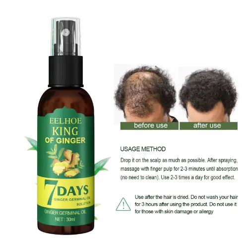 Ginger Essential Oil Spray Conditioner for Hair Regeneration haargroei, vermindert haaruitval en kalmeert de hoofdhuid